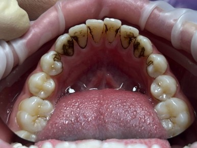 ������ ����� �� �����: ��� ��� � ��� � ��� ��������?