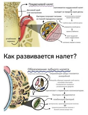 ��� ������ �� �������� ����������� ������� ������?