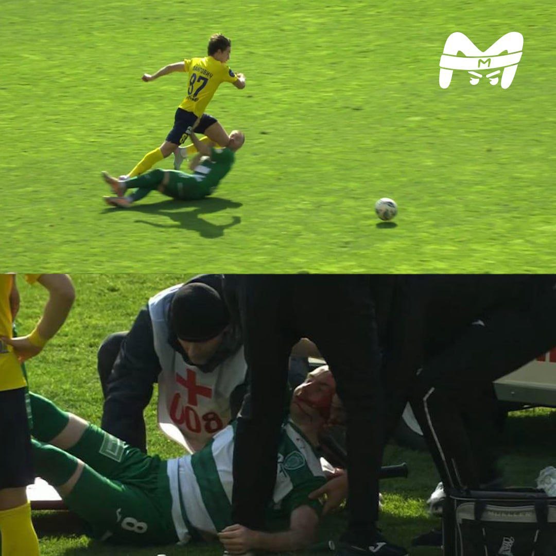 Игрок "Ахмата" Мирослав Богосавац получил травму головы во время матча с "Ростовом"