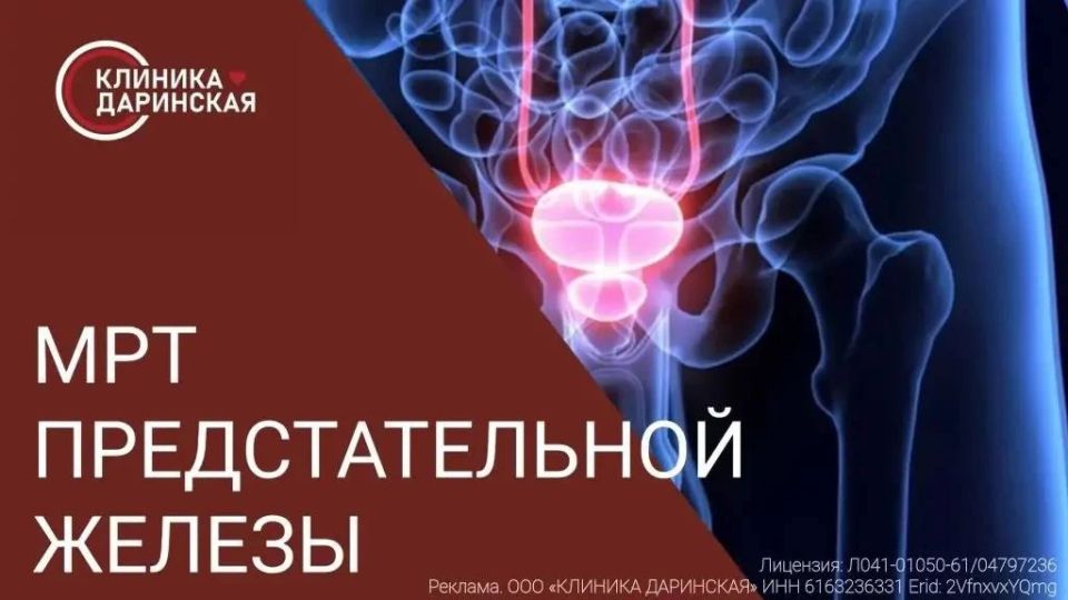 УСЛУГА ДНЯ. Новый уровень диагностики простаты: Мультипараметрическая МРТ (мпМРТ) предстательной железы с контрастным усилением за 12 000 рублей в клинике «Даринская»