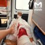 Ольгу Бузову госпитализировали с подозрением на перелом ноги
