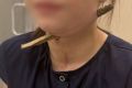 В Ростове хирурги спасли девочку, шею которой насквозь пронзила ветка длиной 14 сантиметров