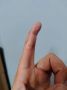 В Ростове врачи шесть часов спасали руку ростовчанина, получившего травму во время ремонта
