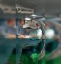 Из-за падения с велосипеда ростовские врачи смогли обнаружить у подростка опухоль, разрушавшую кость ноги