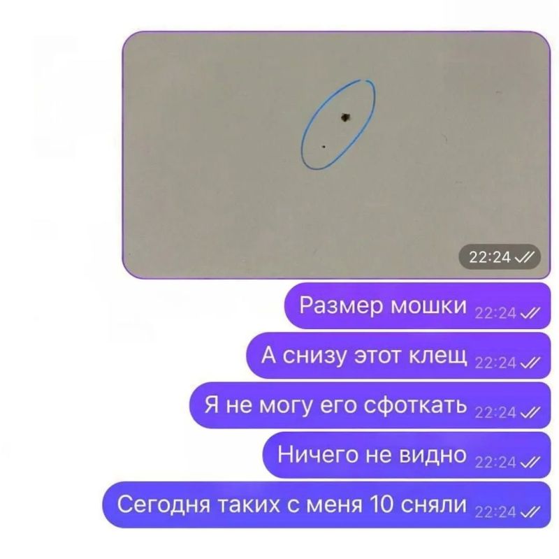 Россиян массово атакуют микроклещи, которых легко спутать с родинкой Россиян массово атакуют микроклещи, которых легко спутать с родинкой