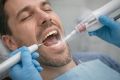 Профессиональная чистка зубов: обязательная мера для заботы о здоровье