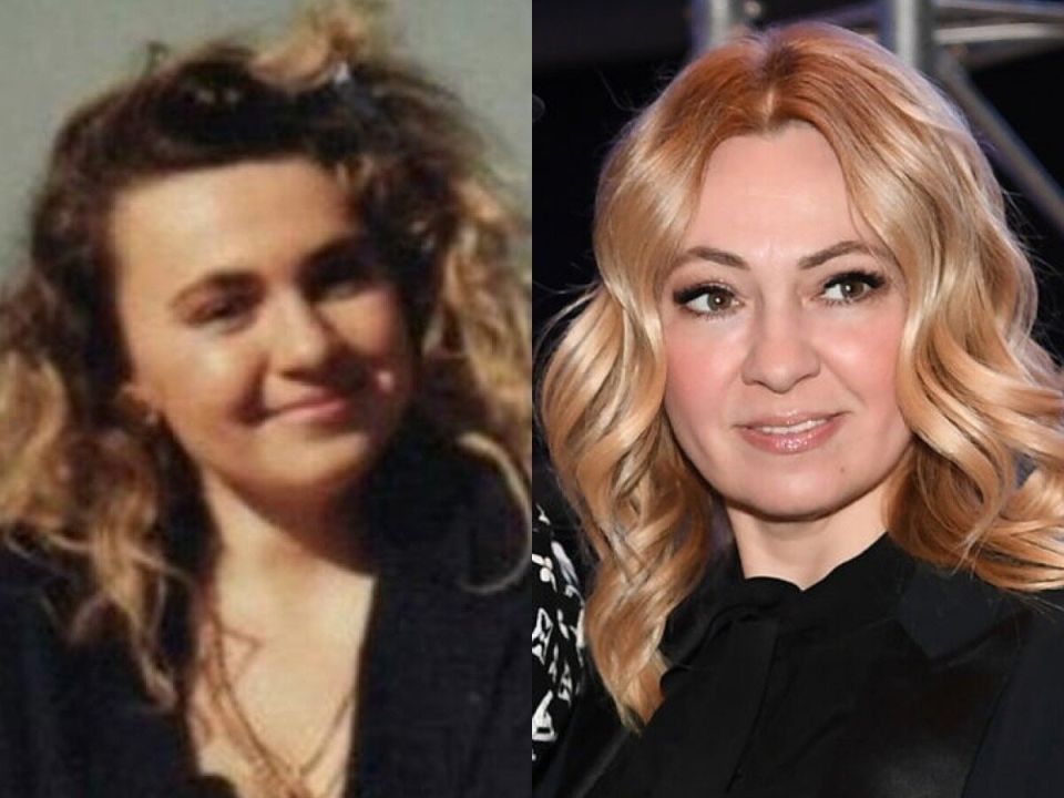 Преображения знаменитостей: от естественных изменений до смелой пластики